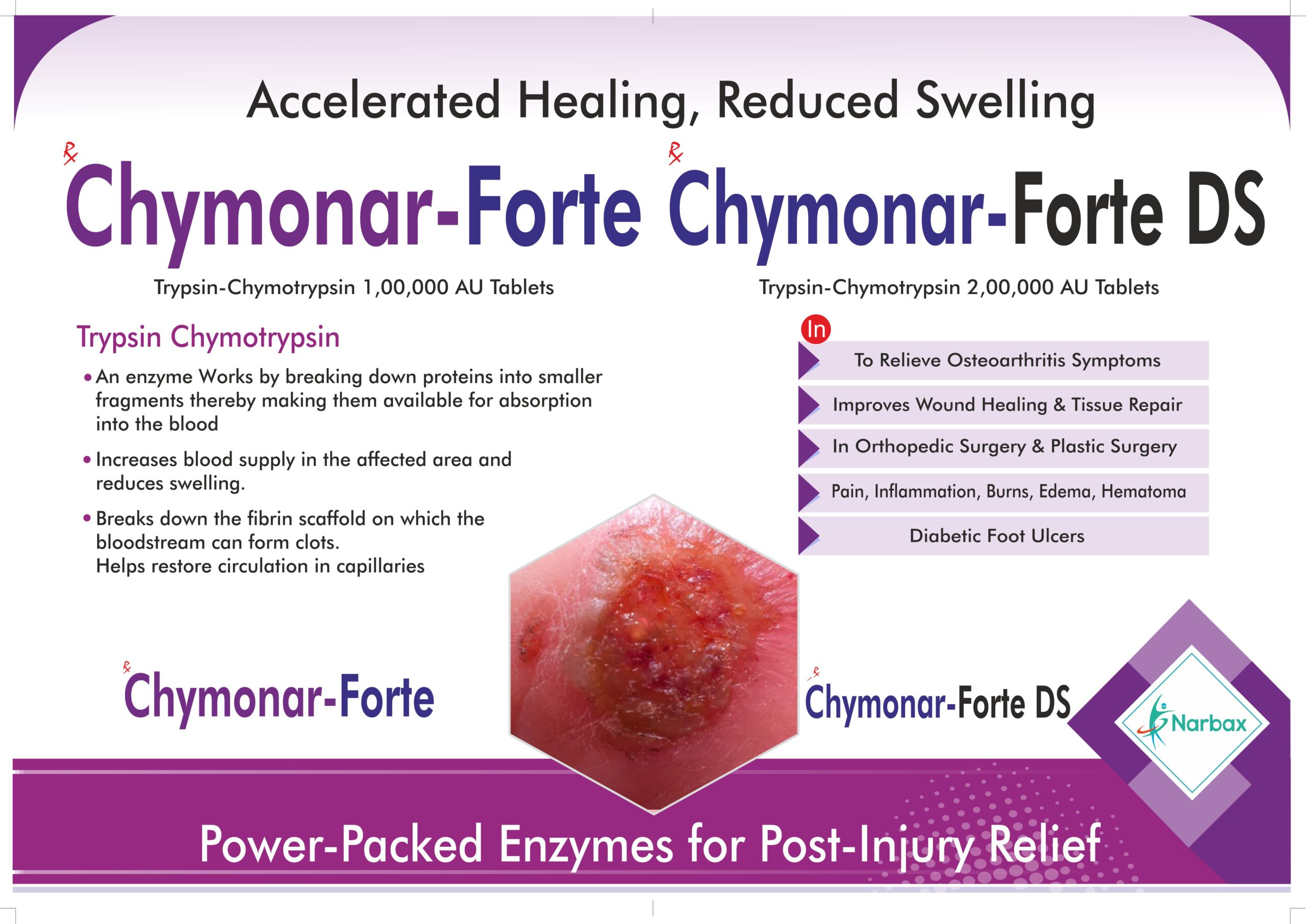 chymonar forte